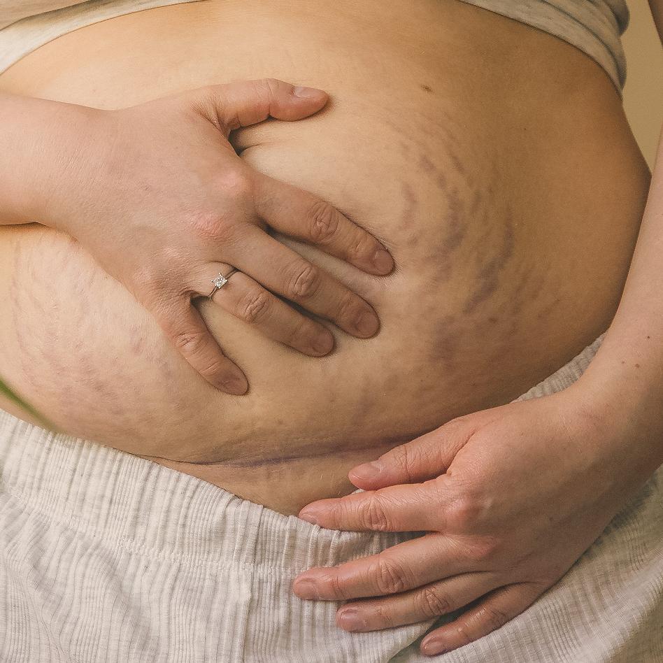 Birth & Recovery    Birth & Recovery