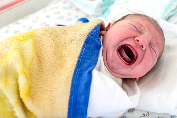  tongue-tie tongue tied newborn 
