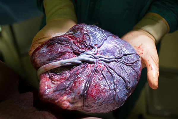  What To Do With Placenta After Birth 