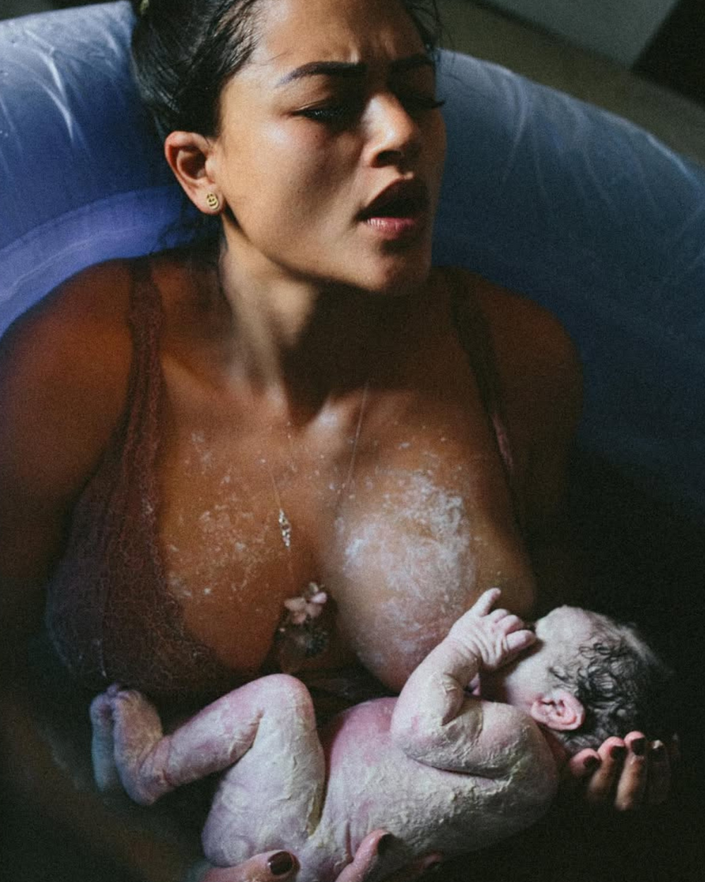  Vernix Caseosa: Baby’s first skincare 