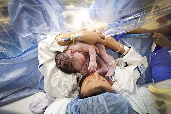 planned caesarean birth newborn c section