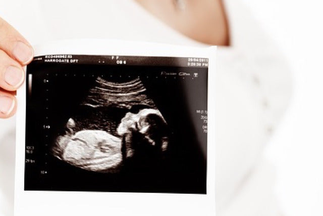 foetus fetus scan baby pregnant