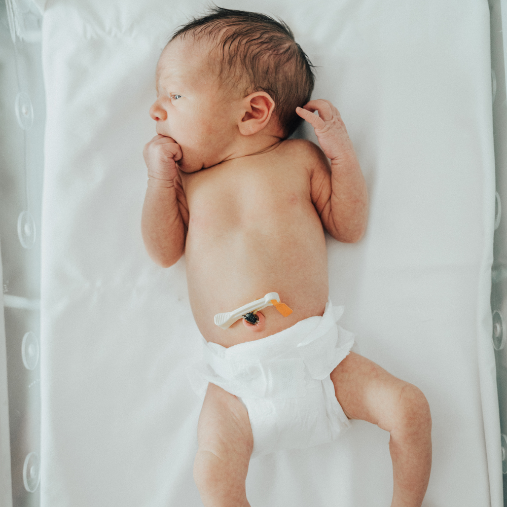  Baby Cord Care: What Parents Need to Know 