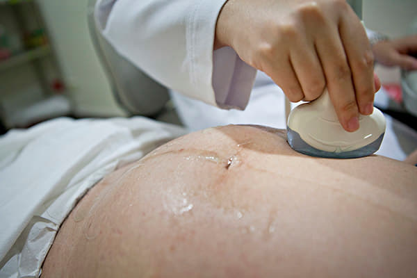  scans scan ultrasound hospital pregnancy 